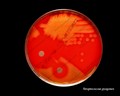 streptococcus pyogenes